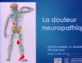 La douleur neuropathique, Communication présentée par Dr H. SI AHMAD  