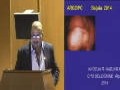 Myomectomie comment gérer l’hémorragie en per opératoire Communication présentée par Dr KHOJA