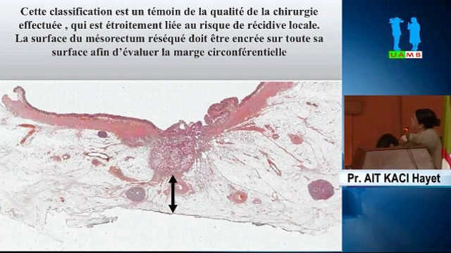 Conférence par Pr. AIT KACI  Anatomopathologie CPMC Alger