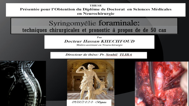 Débat 05, soutenance de doctorat en médecine Dr KHECHFOUD