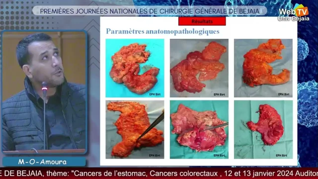 Conférence animée par :Dr. M-O-AMOURA, Servie de chirurgie générale, EPH de Birtraria