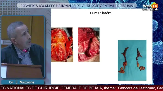 Conférence animée par :Pr E. MEZIANE, Service de chirurgie générale, CHU Bab El Oued – Alger, Algérie.