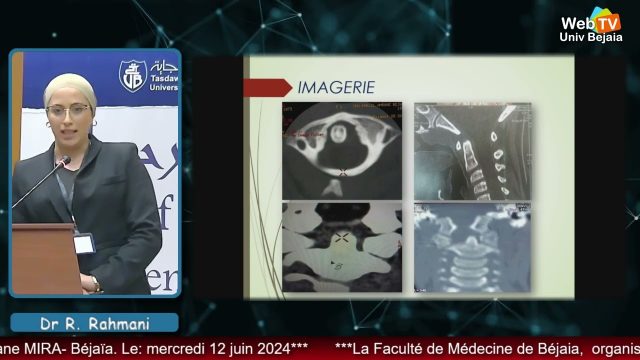 Conférence animée par: Dr R. RAHMANI, K. Djoulane, A. Abdelmalek, H. Bekralas, Résidente, Service Neurochirurgie, CHU Béjaïa, Faculté de Médecine-Bejaïa